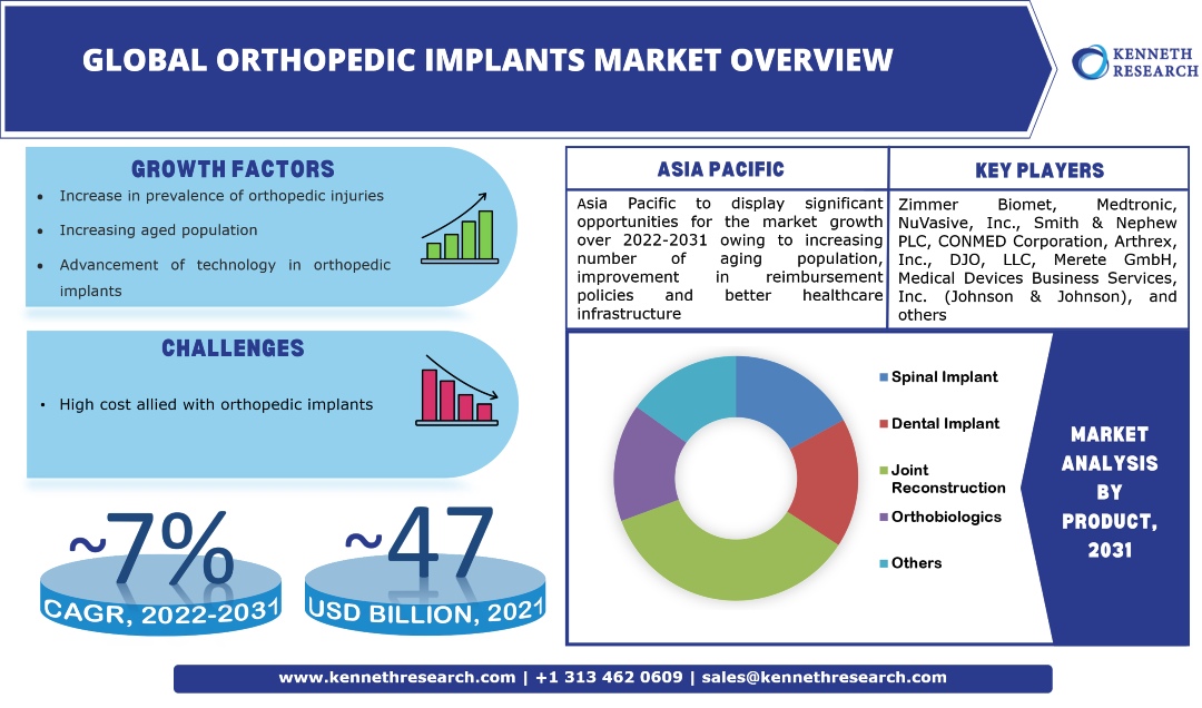 Global Orthopedic Implant Market Trends & Industry Analysis, Forecast